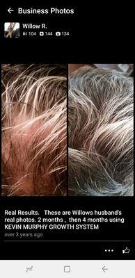 Hair Growth Treatment AVAILABLE