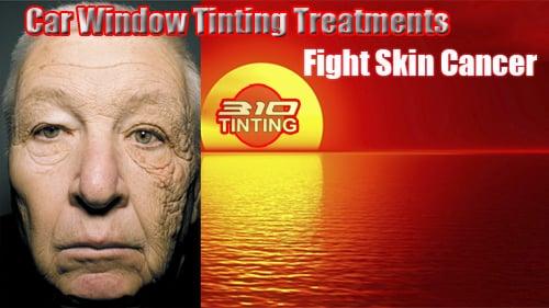 window tinting treatment in los Angeles fight UV ray elements rejecting sun heat radiation to avoid burn skin cancer conditions