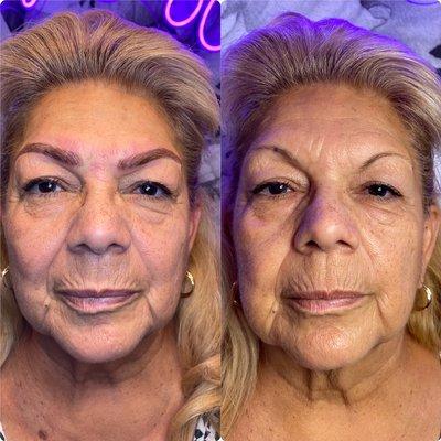 Microblading before and after, completely made her look younger.