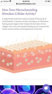 How does MicroChanneling work ?