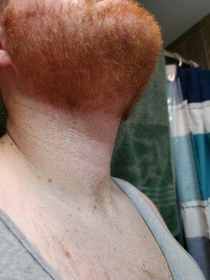 Big chunk out of his neckline, uneven line, long chunk