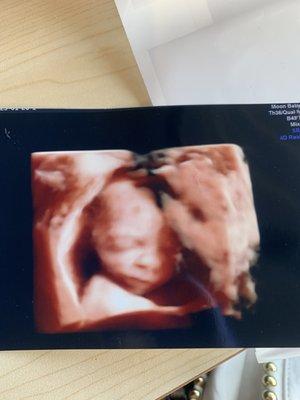 HD image at 21 weeks