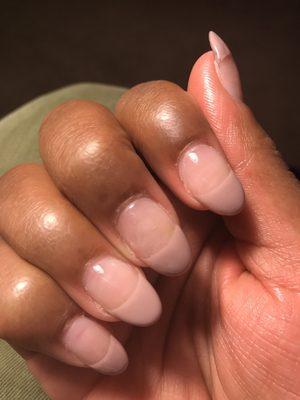 look at the cuticle area ..