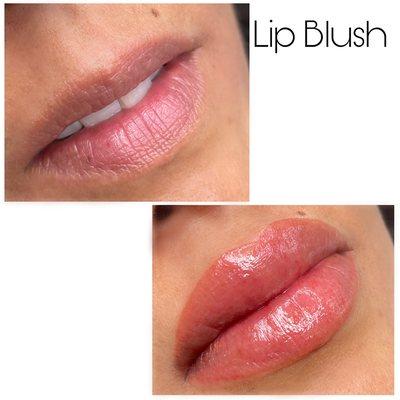 Lips contour correction