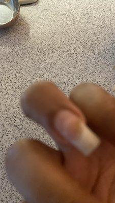 Here's the second fungus! In the other ones on my pinky where the guy lied to me saying it was just a bruise