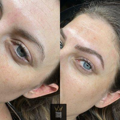 Microblading