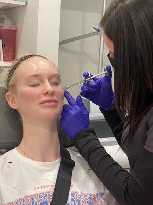 Our lovely RN Laura injecting this beautiful client's cheeks after a HydraFacial with Daisy!