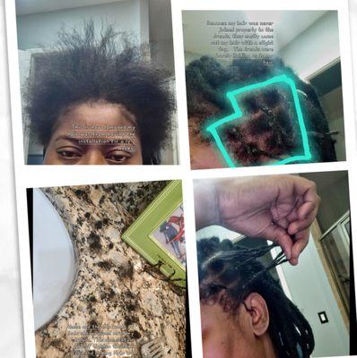 These pics shows the damage to my hair from the shoddy install of the dreads.   Thre was never a connection between my hair and the dreads