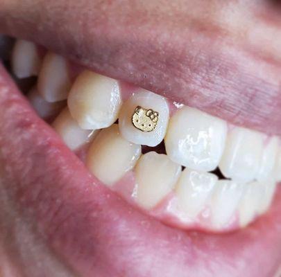 18 k gold tooth gem