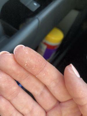 Leftover on my hands as under my nails from after my manicure