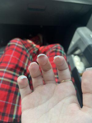 gunk left underneath nails