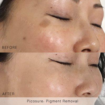 Incredible results every time!