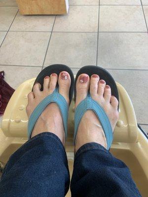 Pedicure