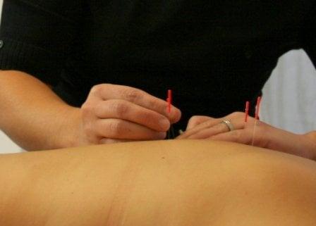 Acupuncture & Chinese Herbal Medicine