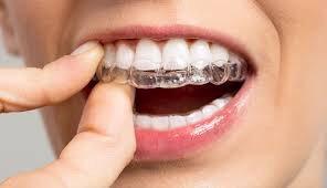 Clear aligners can straighten your smile fast. Call today for a consult to straighten your smile. 480-507-1807