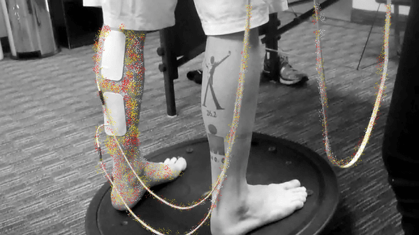 Phoenix AC/DC Waveform Neuromuscular Therapy