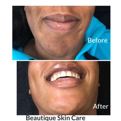 Beautique Skin Care And Body Studio