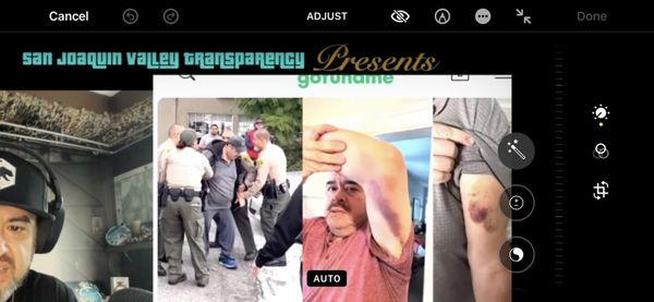 Damage Temple city Sheriff Deputies did assaulting elderly man for taking photos!