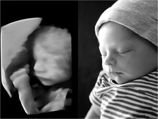 20 week ultrasound compared to newborn photo...Wow!