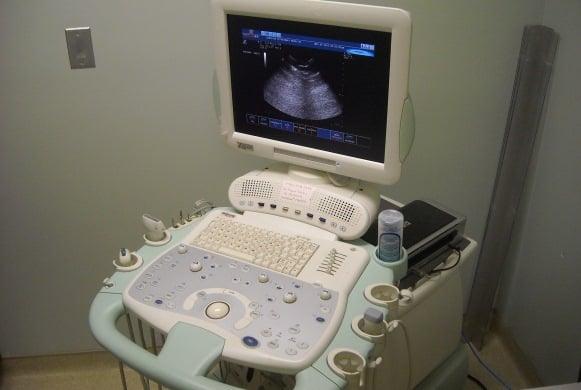 Ultrasound machine.