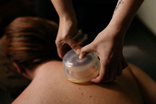 Myofascial Cupping