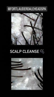 Scalp cleanse before and after