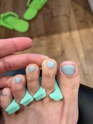 Botched pedicure