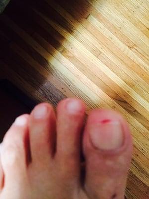 Jenny Nails -- Monroe Ave....toe disaster