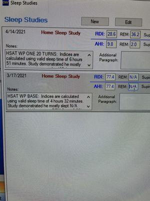 My sleep apnea dropped from AHI of 77 (severe) to an AHI of 9 (mild) and I feel great!