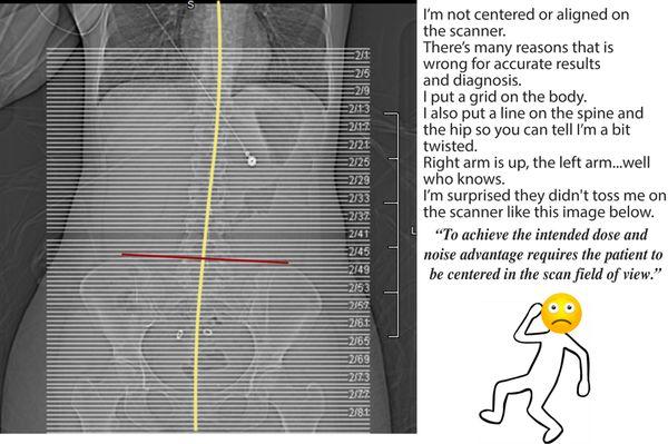 2018 report-they outsourced-radiologist in Glendale. I had to be get scans for 3 years what they missed.