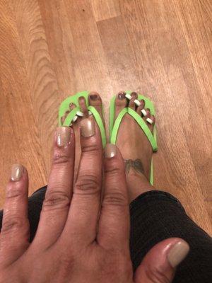 Nails and feet