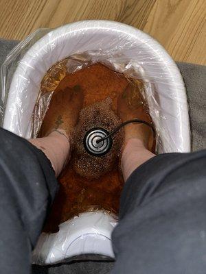 End result of Ionic Foot Detox Bath