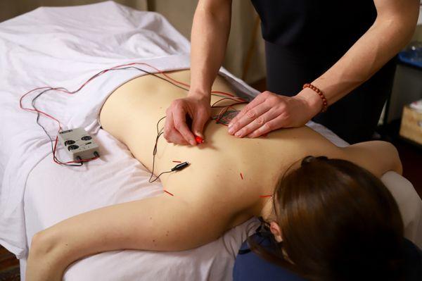 Brooke using an E-Stim treatment during an Acupuncture session