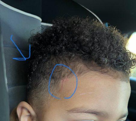 Circled the cut on head and uneven curls