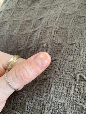 Nail after two weeks of SNS; fungus present that was not there prior to service