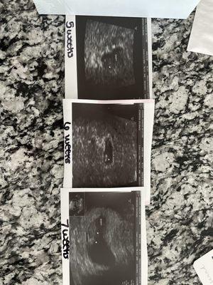 Baby's week to week photos!