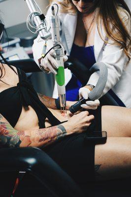 Laser Tattoo Removal