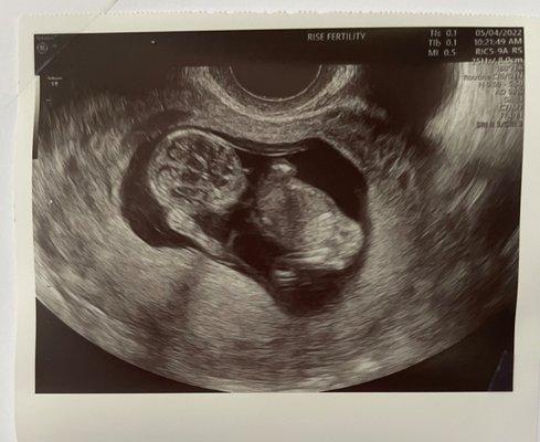 Baby girl waving at us!