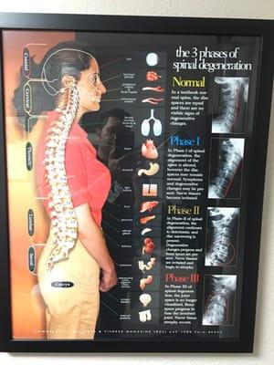 It's so true how your lower back pain can affect your body