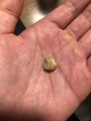 He thought his tooth fell out...size of a small tooth.