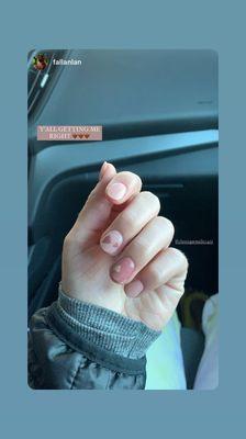 Natural nails