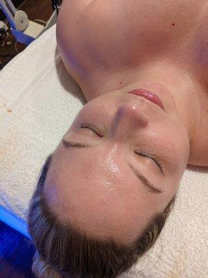 Hydrafacial by Stephanie. My skin was glowing for days.