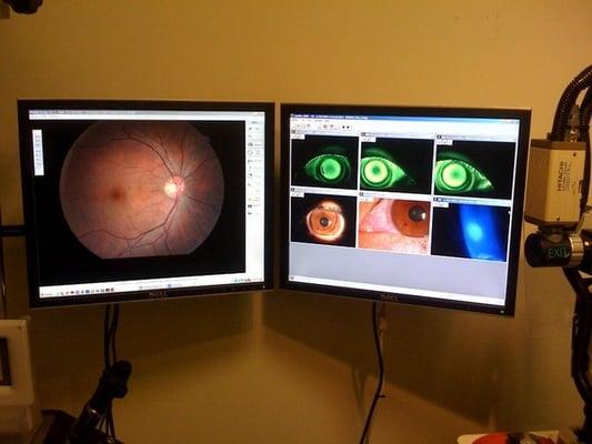 Anterior and posterior segment digital imaging