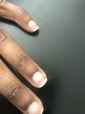 Cuts on ring and pinky finger