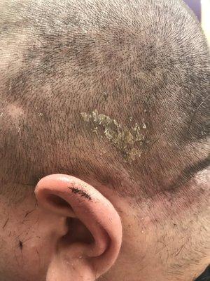 Scalp issues