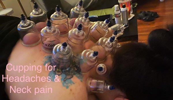 Cupping