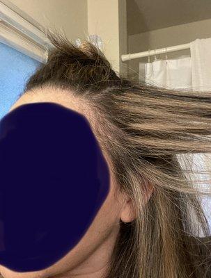 Brittle dry hair