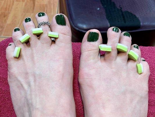 Why are my big toes so uneven? And Wheres the Xmas tree I requested? Just gotta laugh. ‍