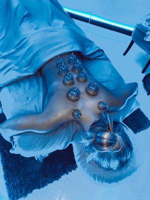 Cupping and Massage Therapy