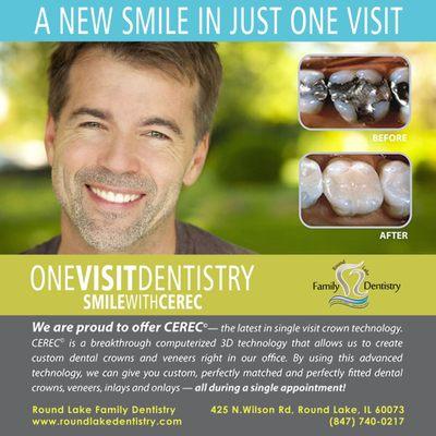 Your Round Lake Dentists now offer Cerec - Same Day Crowns @ Round Lake Family Dentistry